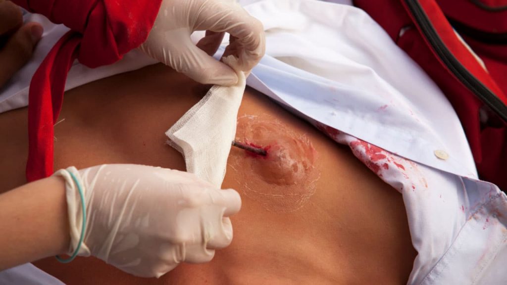 A person in medical gloves carefully tends to a wound on a person's abdomen, applying a bandage. The person is wearing a white shirt with some visible blood stains.
