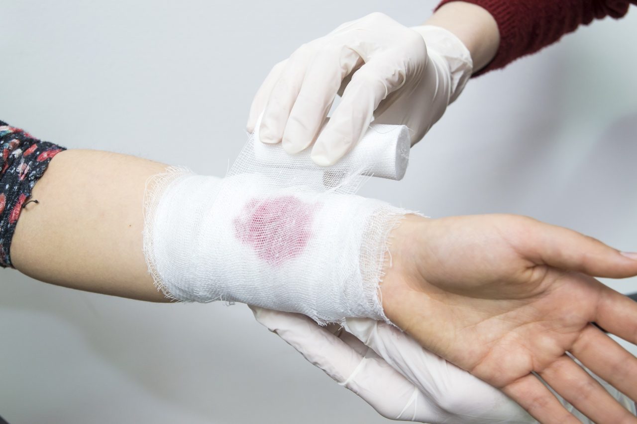 A healthcare professional wearing gloves is bandaging a wound on a person's wrist. The bandage has a visible bloodstain. The person receiving care has a floral-patterned sleeve, and the professional is wearing a burgundy sleeve.