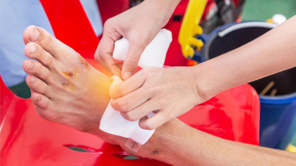 A paramedic applying medical gauze to a person's foot to treat a bruise and prevent further injury.