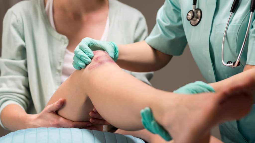 A woman in a doctor's clinic holding her knee while the doctor examines a bruise on her knee.