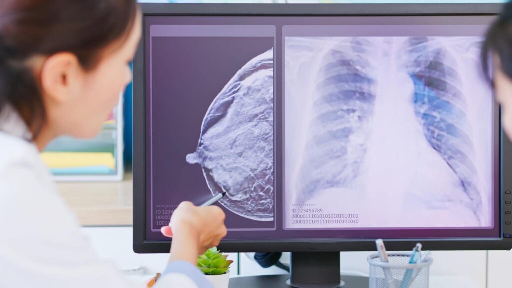 A healthcare professional points at a computer screen displaying medical images, including a mammogram and a chest X-ray. Pens and office supplies are in the foreground on a desk.