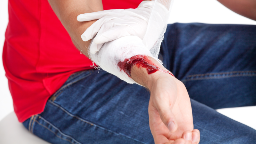 A person in a red shirt and blue jeans is having a bandage wrapped around a bleeding wound on their forearm. A white-gloved hand is applying the bandage, indicating first aid being administered.